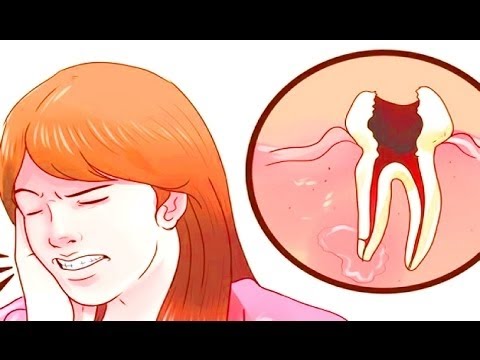 تسكين ألم الأسنان