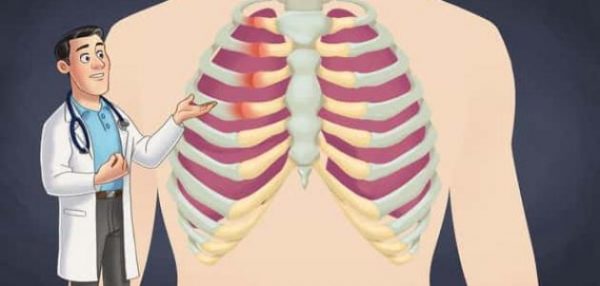 أعراض التهاب عضلات القفص الصدري